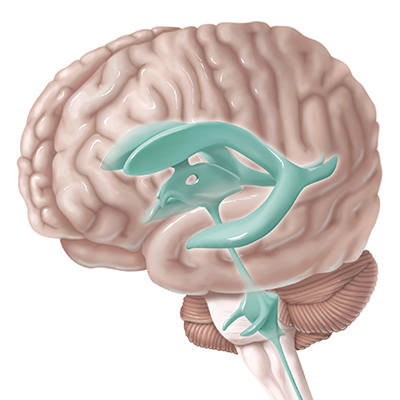 Anatomic - Brain Ventricles - Evelyn Lockhart